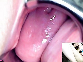 Adalynnx - एंडोस्कोप स्पेकुलम हिताची वाइब्रेटर सह